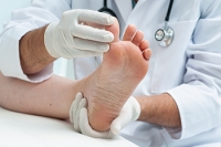 Athlete’s Foot Affects More Than Athletes
